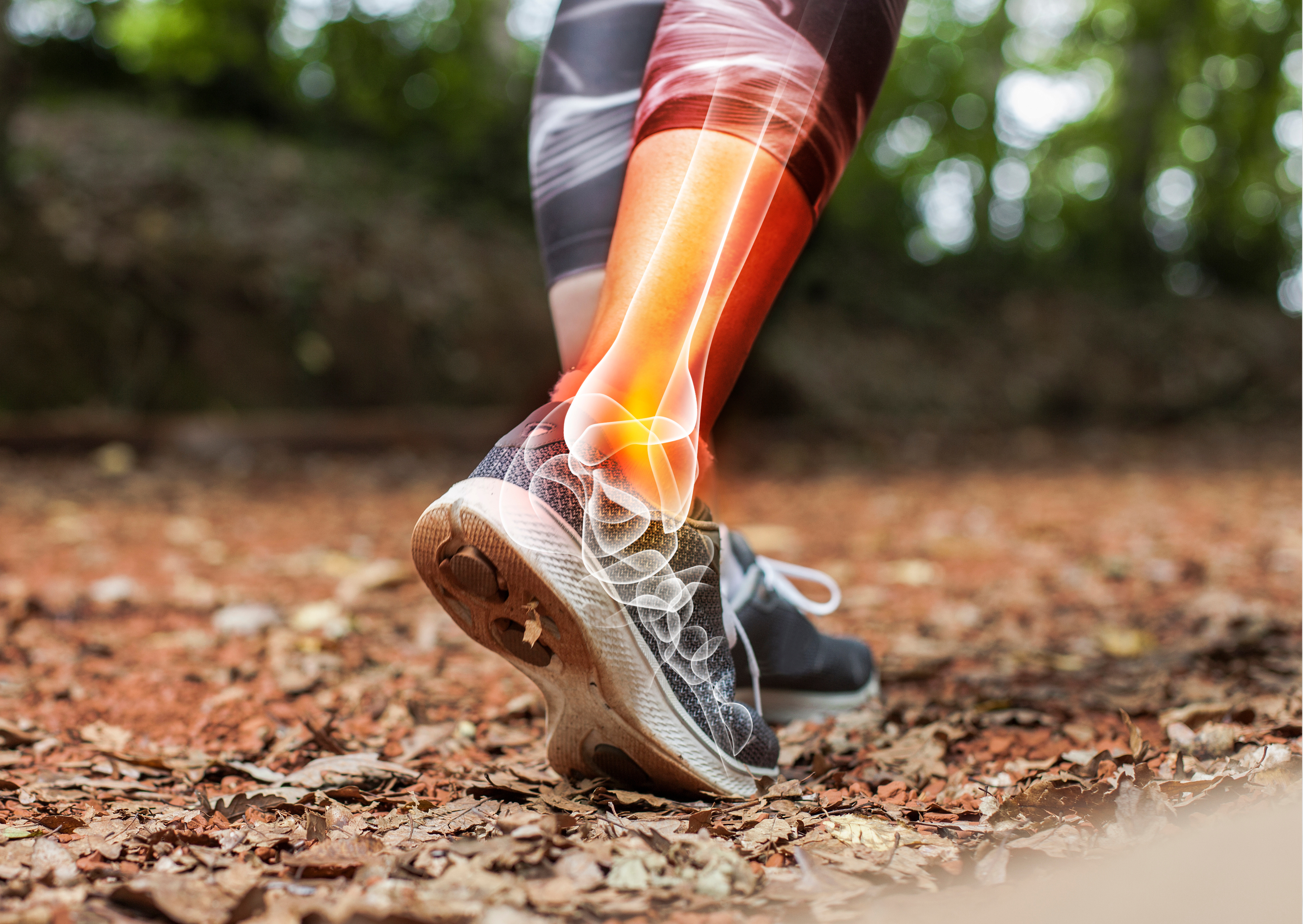La Protesi di Caviglia: Chirurgia e Riabilitazione