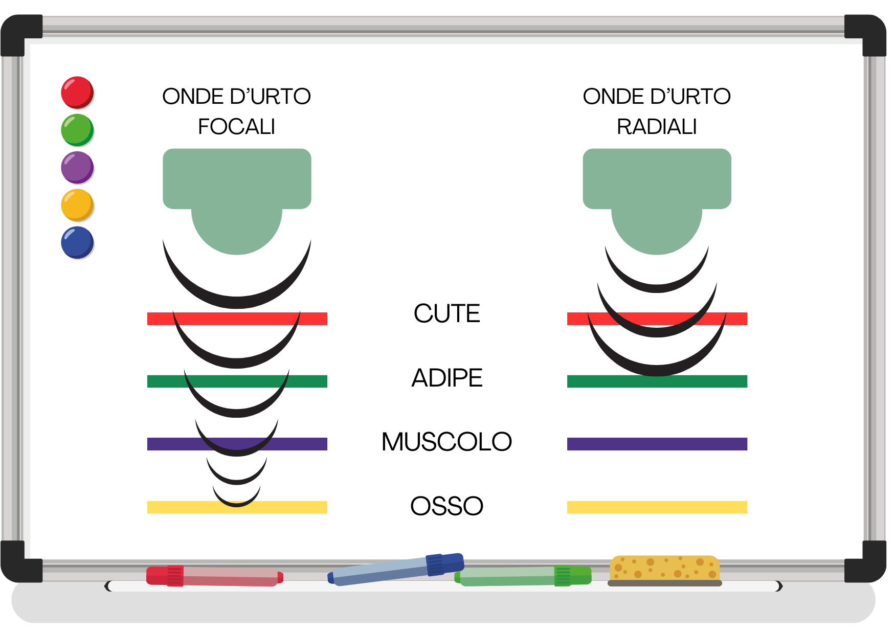 Qual è la Differenza tra Onde d’Urto Focali e Radiali